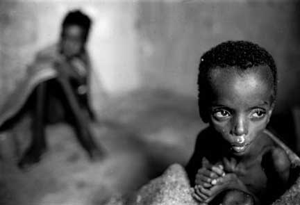 UNICEF A Call For Aid To Help Somalia'­s Undernourished Children